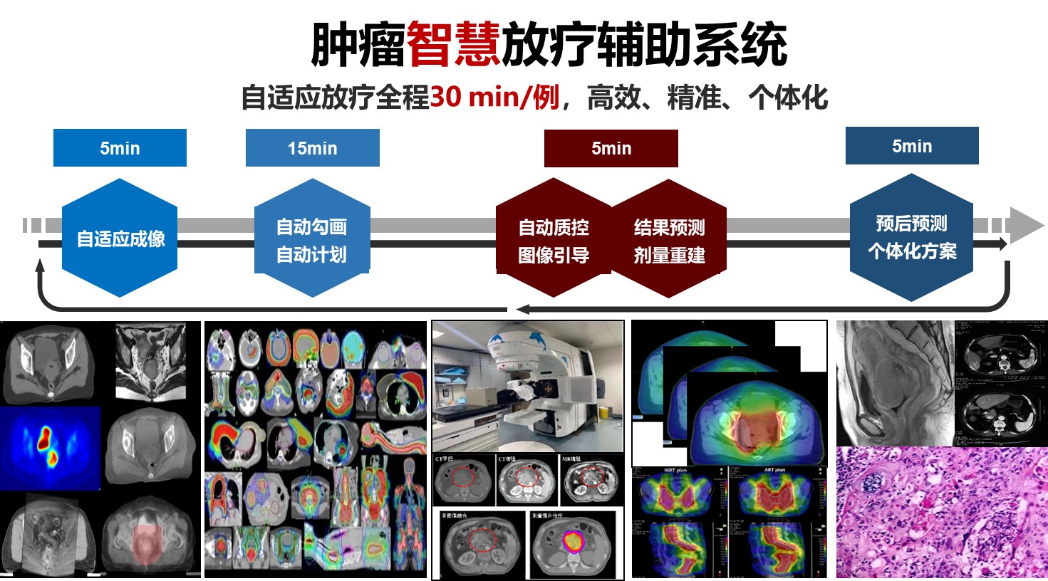 腫瘤智慧放療輔助系統